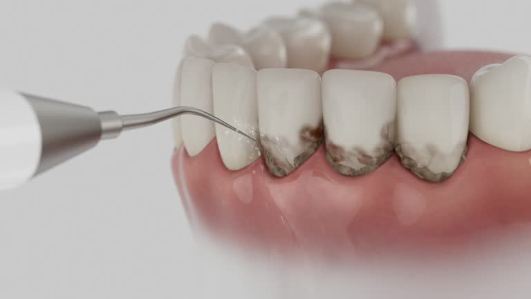 Trusted Emergency Dentist service in Echelon, NJ - Dentist Open Now